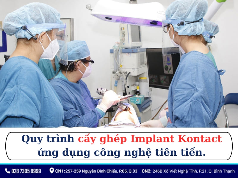 trụ implant kontact