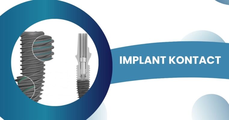 trụ implant kontact