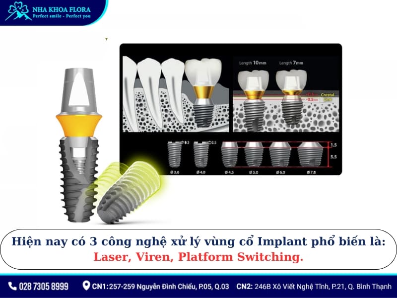 trụ implant mỹ