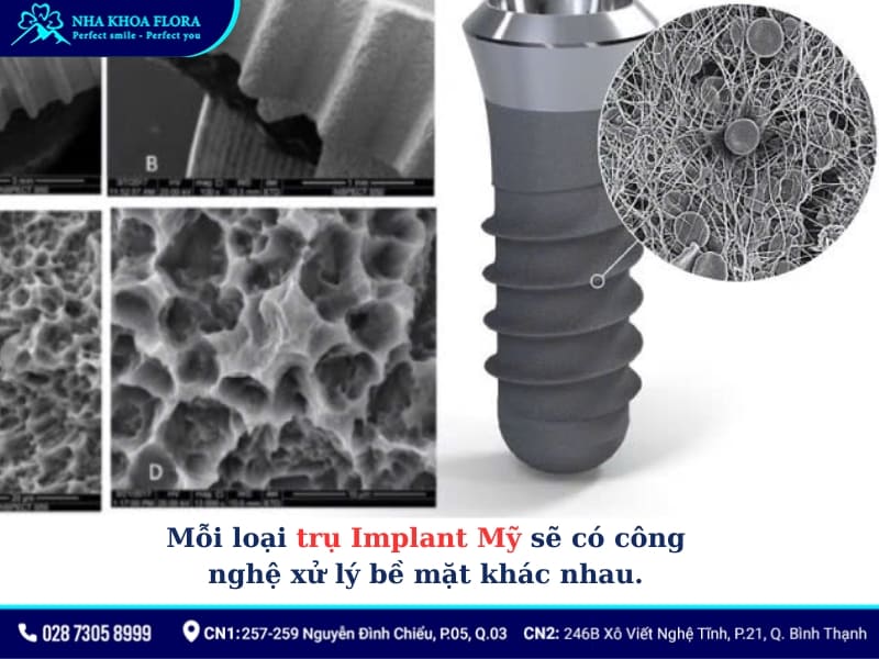 trụ implant mỹ