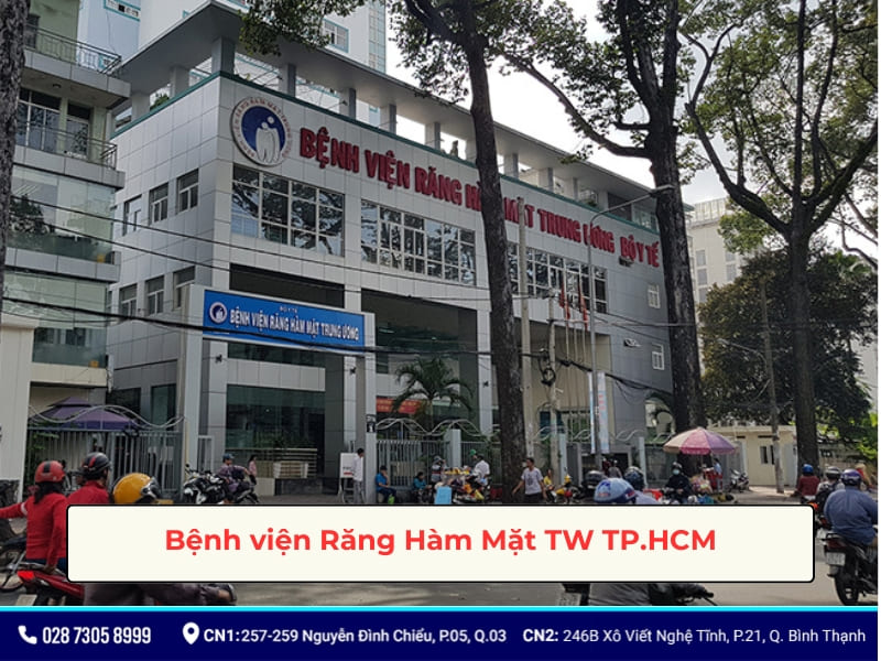 bảng giá trồng răng implant bệnh viện răng hàm mặt