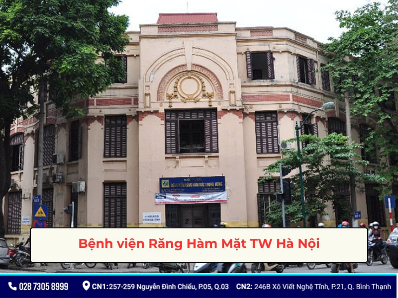 bảng giá trồng răng implant bệnh viện răng hàm mặt