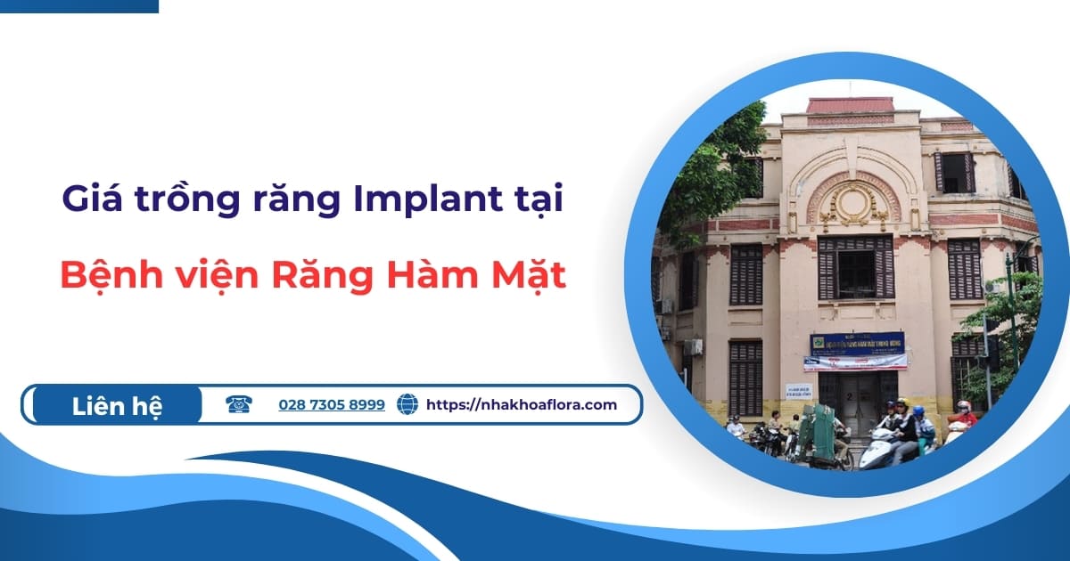 bảng giá trồng răng implant bệnh viện răng hàm mặt