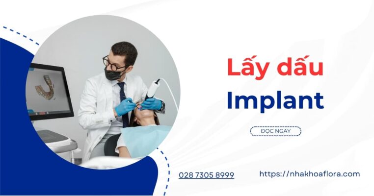 lấy dấu implant