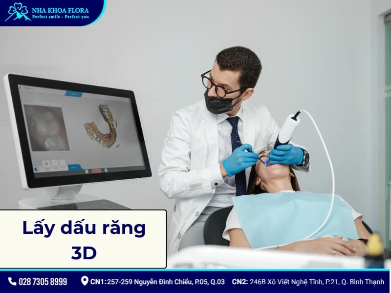 lấy dấu implant