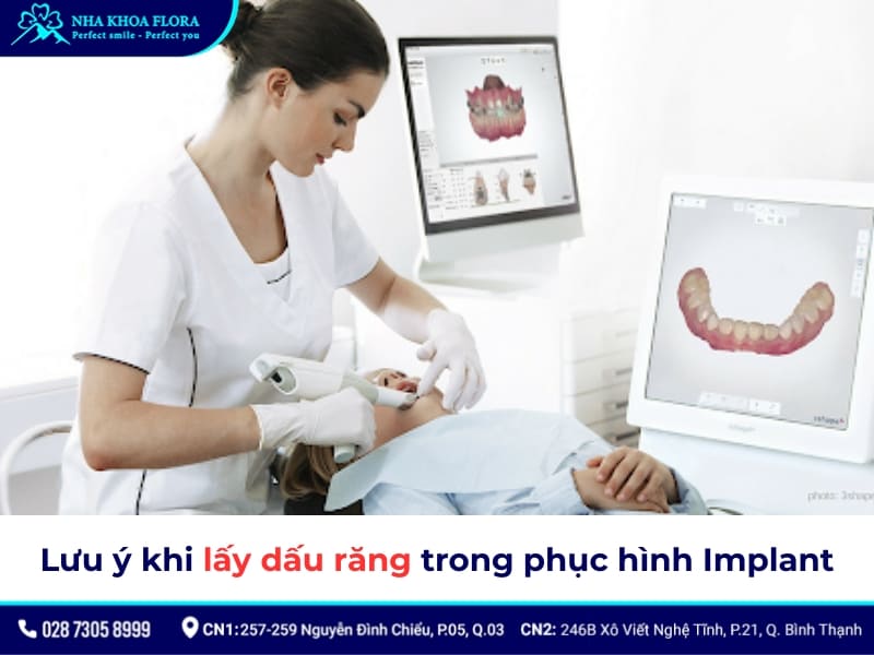 lấy dấu implant