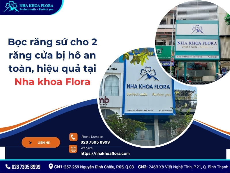bọc răng sứ 2 răng cửa bị hô