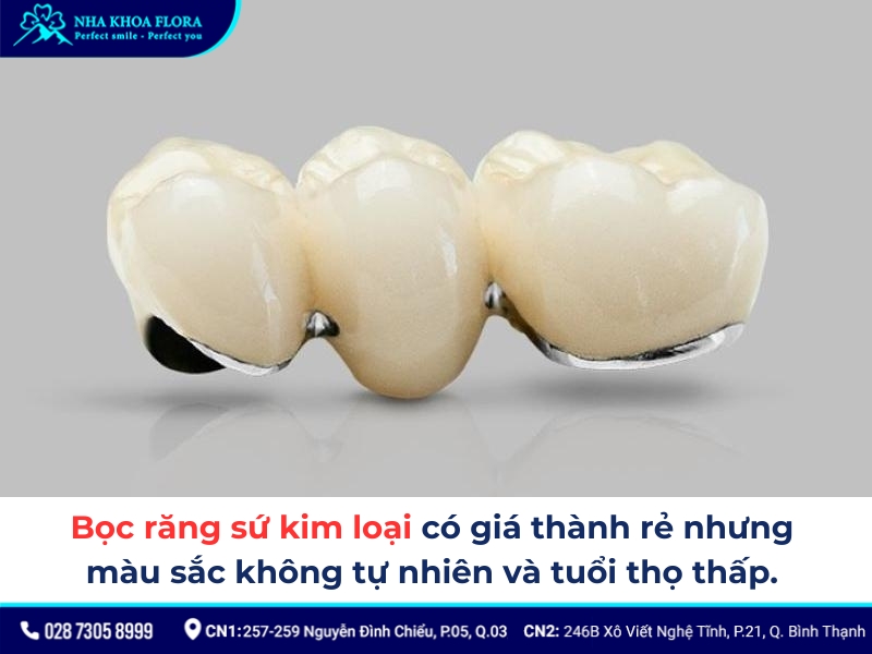 bọc răng sứ 2 răng cửa bị hô