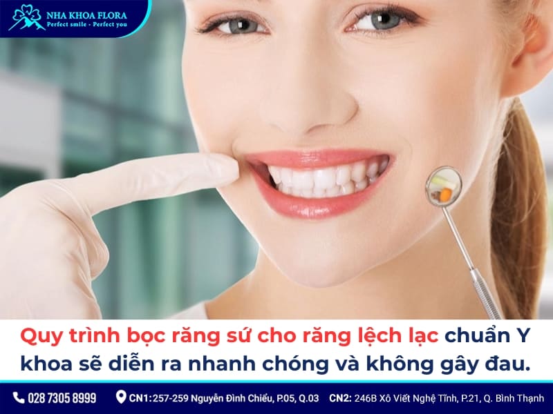 bọc răng sứ cho răng lệch lạc