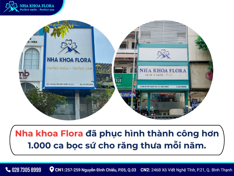 bọc răng sứ cho răng thưa