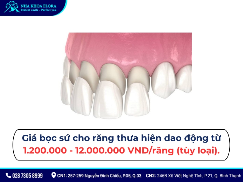 bọc răng sứ cho răng thưa