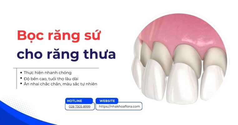 bọc răng sứ cho răng thưa