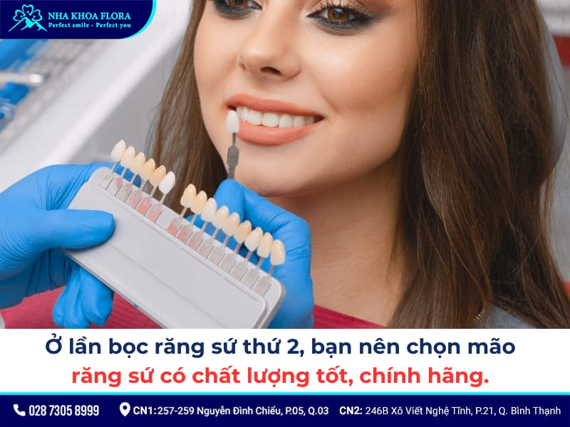 bọc răng sứ lần 2
