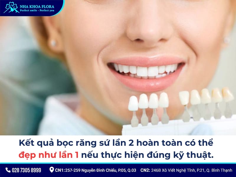 bọc răng sứ lần 2