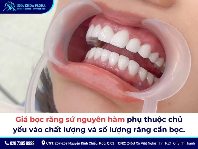 bọc răng sứ nguyên hàm