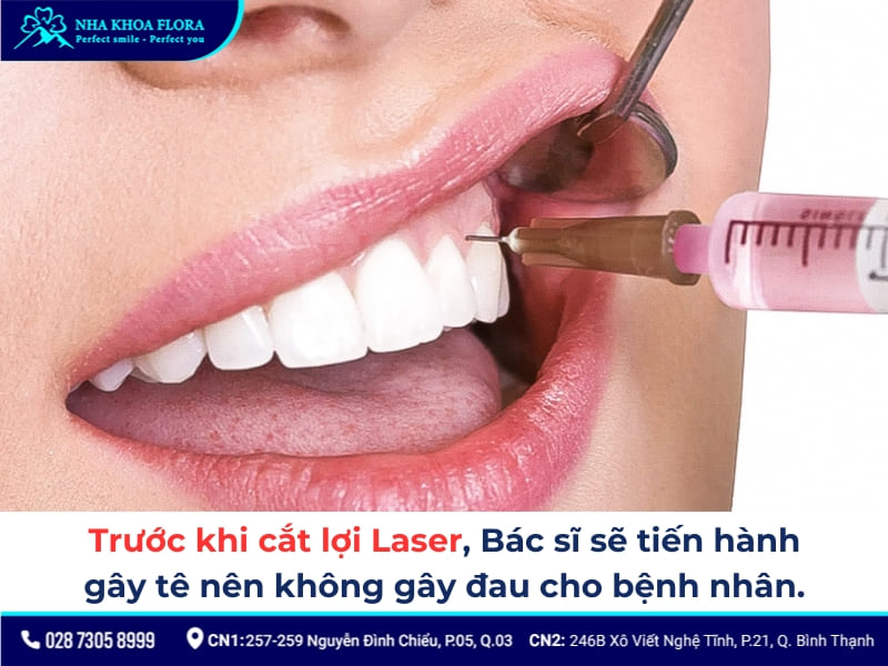 cắt lợi laser