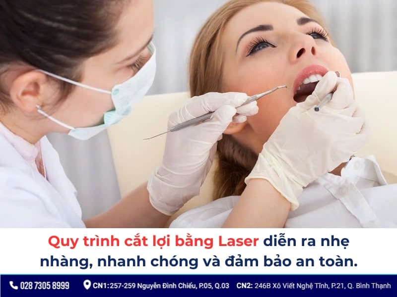 cắt lợi laser