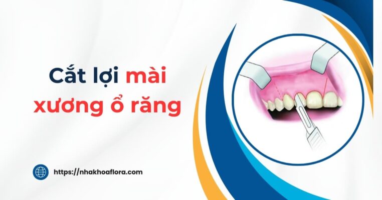 cắt lợi mài xương ổ răng