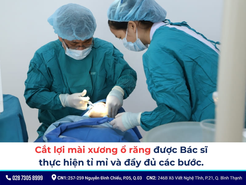 cắt lợi mài xương ổ răng