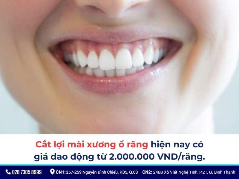 cắt lợi mài xương ổ răng