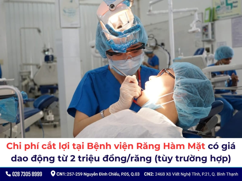 cắt lợi ở bệnh viện răng hàm mặt