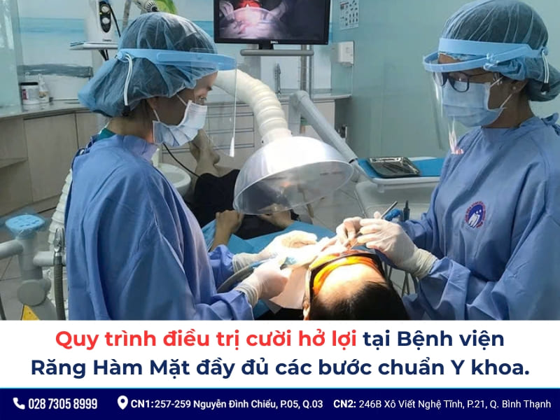 cắt lợi ở bệnh viện răng hàm mặt