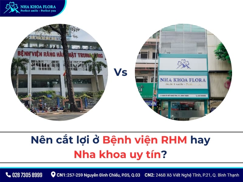cắt lợi ở bệnh viện răng hàm mặt