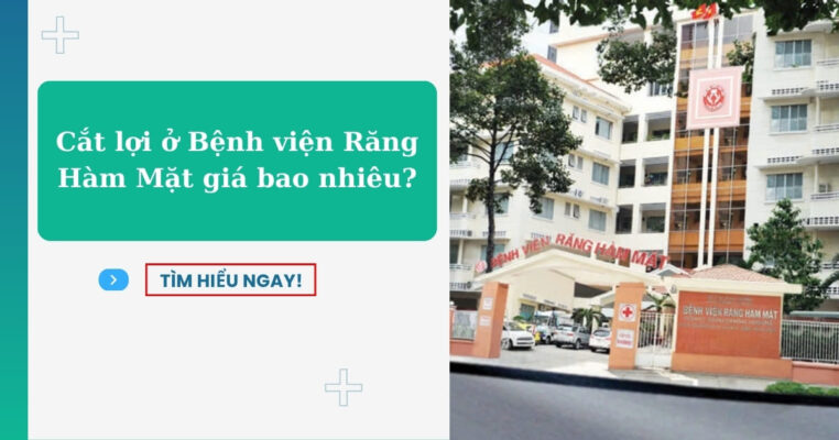 cắt lợi ở bệnh viện răng hàm mặt