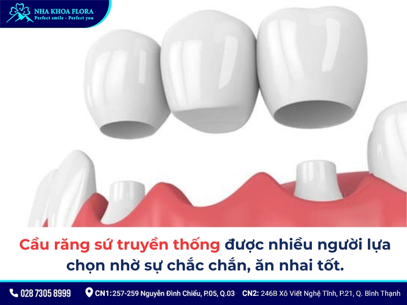 cầu răng sứ