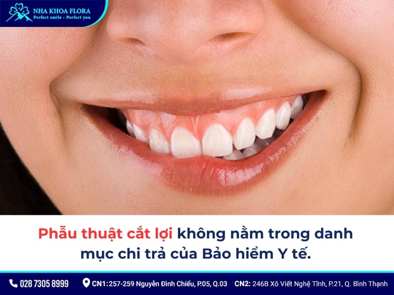 chi phí cắt lợi