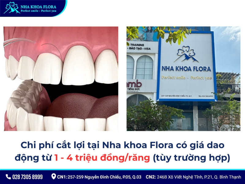 chi phí cắt lợi