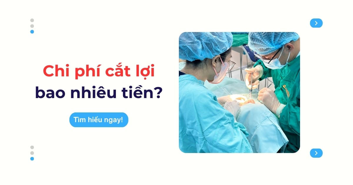 chi phí cắt lợi