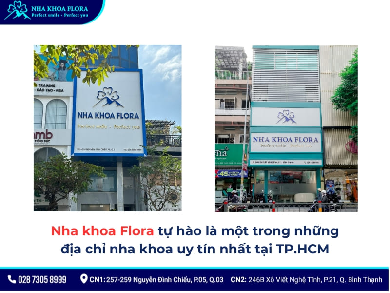 hở lợi chân răng