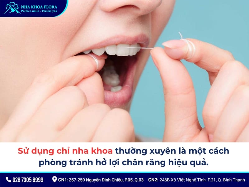 hở lợi chân răng