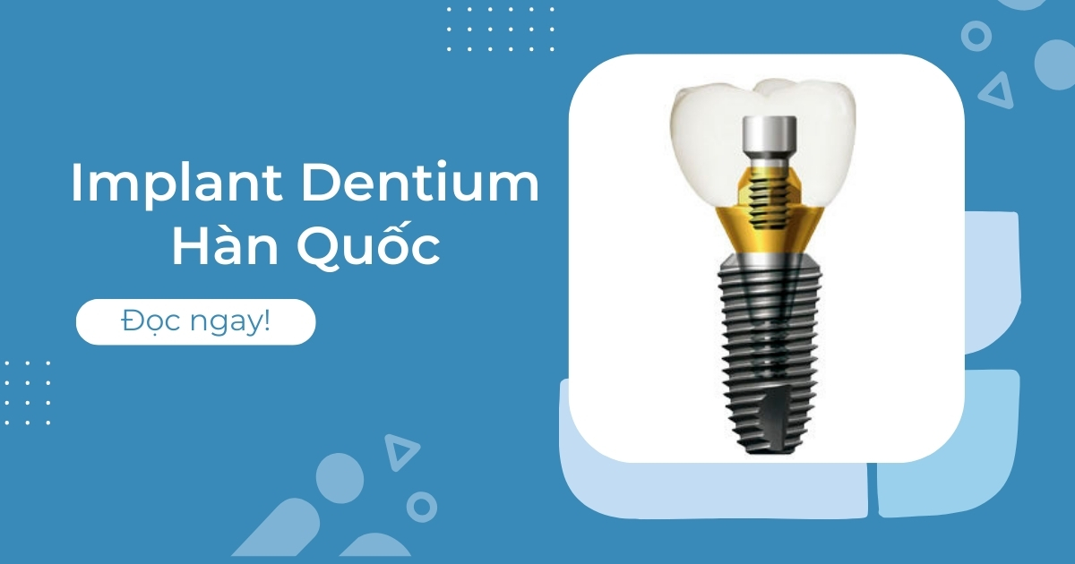implant dentium hàn quốc