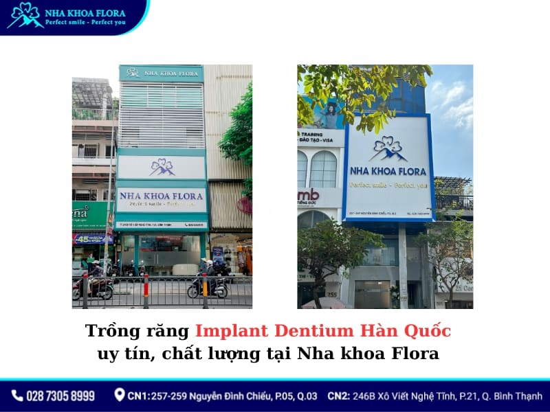 implant dentium hàn quốc
