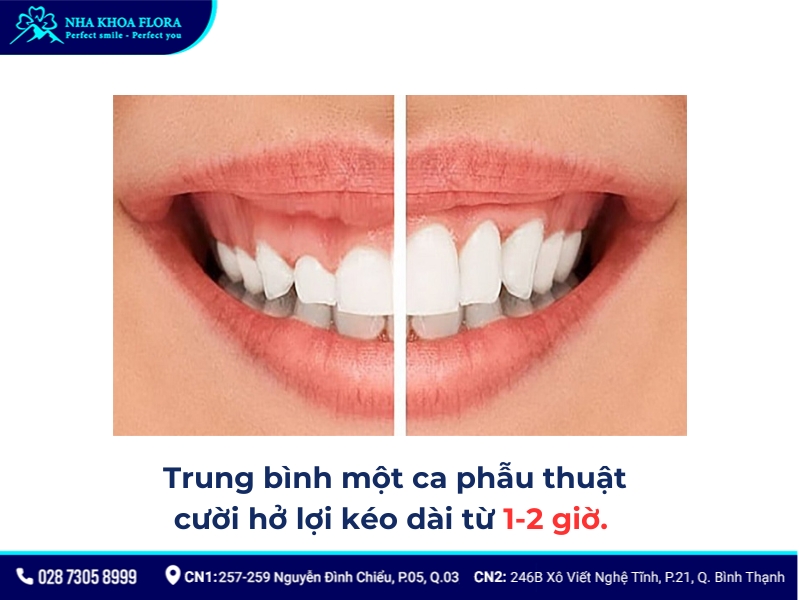 kinh nghiệm phẫu thuật cười hở lợi
