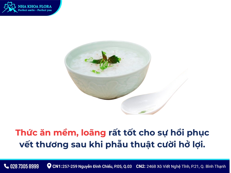 kinh nghiệm phẫu thuật cười hở lợi