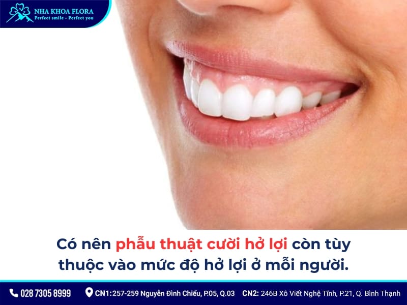 kinh nghiệm phẫu thuật cười hở lợi 