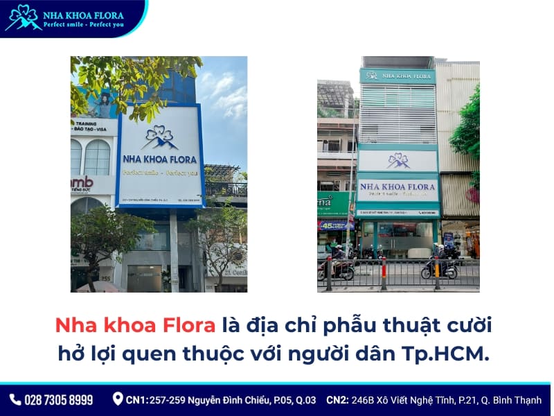 kinh nghiệm phẫu thuật cười hở lợi