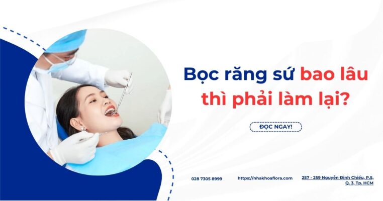 bọc răng sứ bao lâu thì phải làm lại