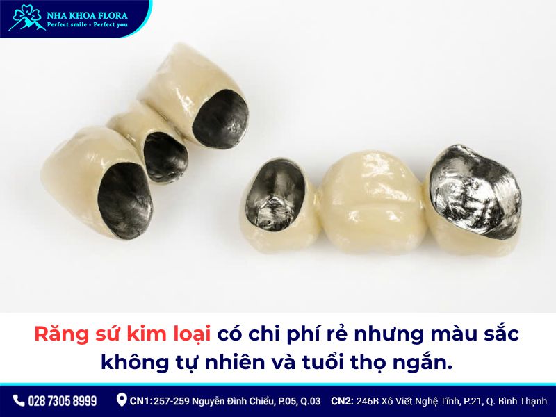 bọc răng sứ bao lâu thì phải làm lại