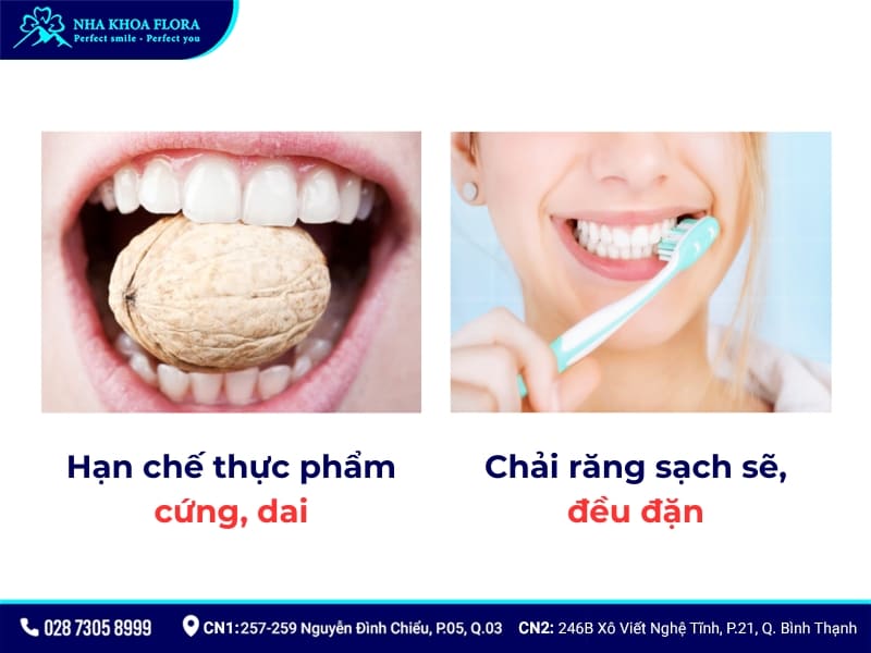 bọc răng sứ bị hỏng