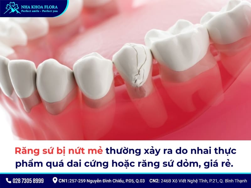 bọc răng sứ bị hỏng