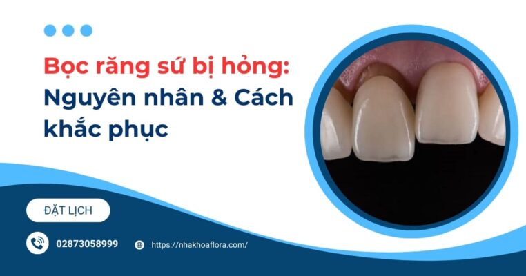 bọc răng sứ bị hỏng