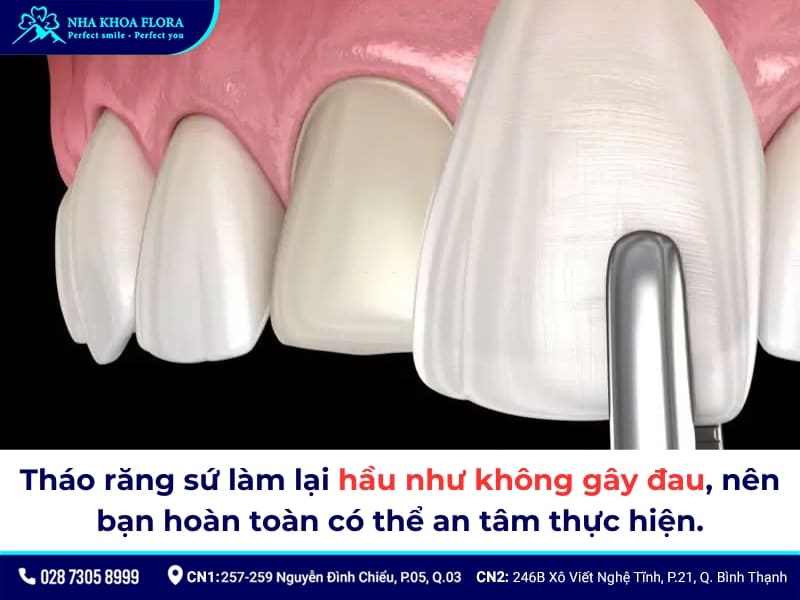 bọc răng sứ bị hỏng