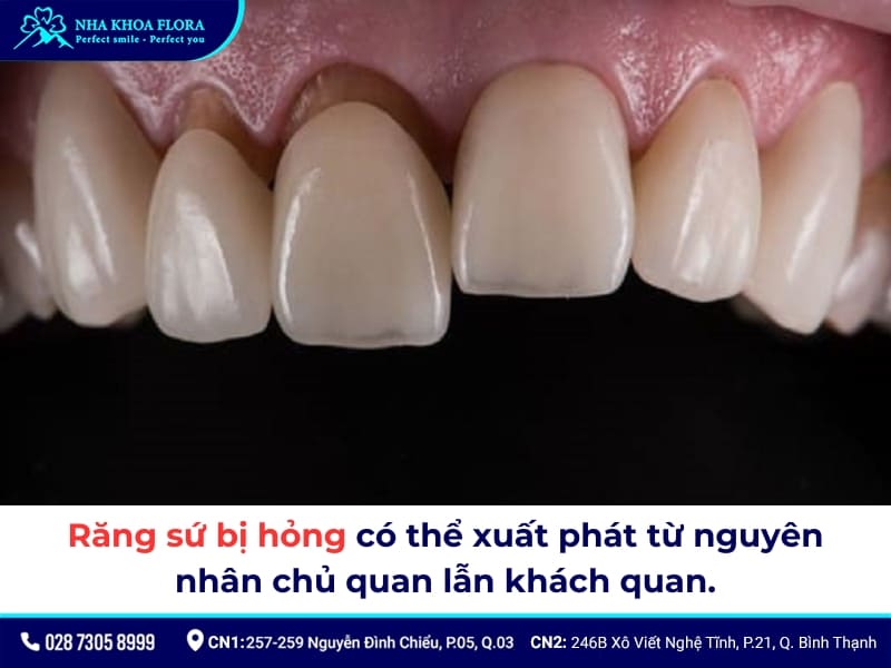bọc răng sứ bị hỏng