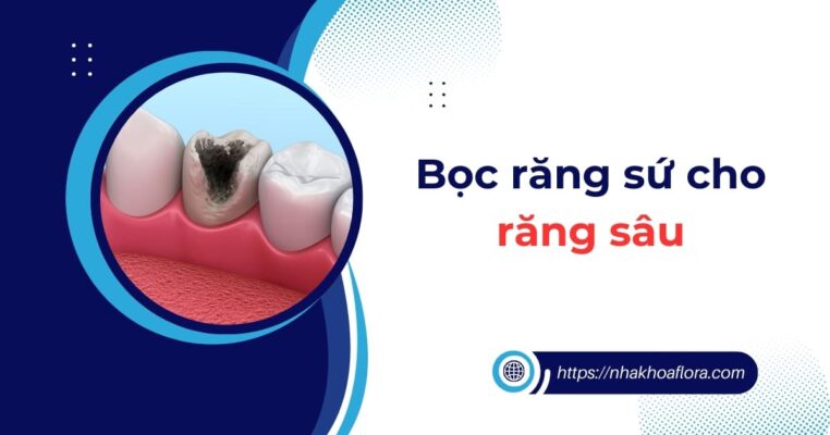 bọc răng sứ cho răng sâu