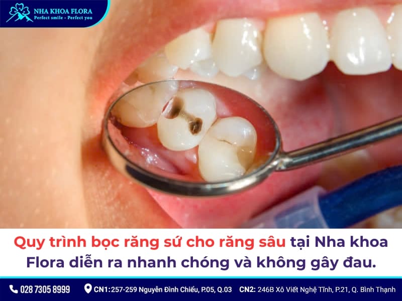 bọc răng sứ cho răng sâu