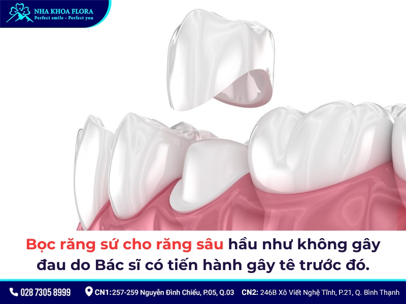 bọc răng sứ cho răng sâu